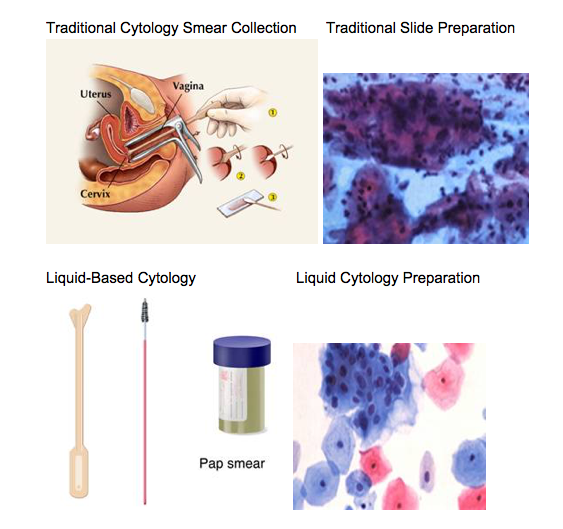 Cervical Cytology Apgo 0023